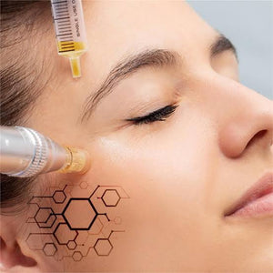 Exosomas + Micropunciones